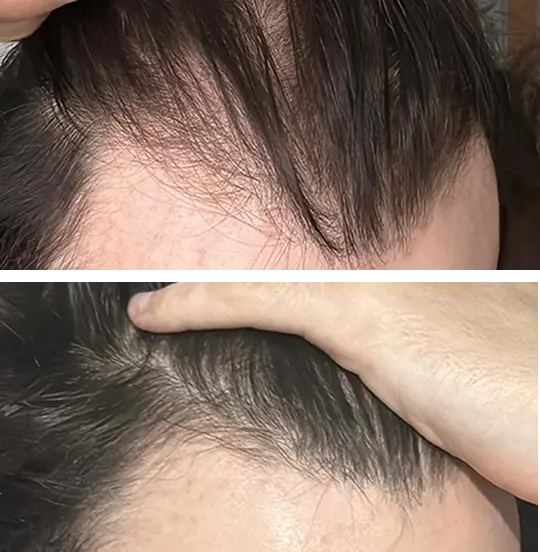 Root Activator Shampoo™ - Sale 29 real result 2